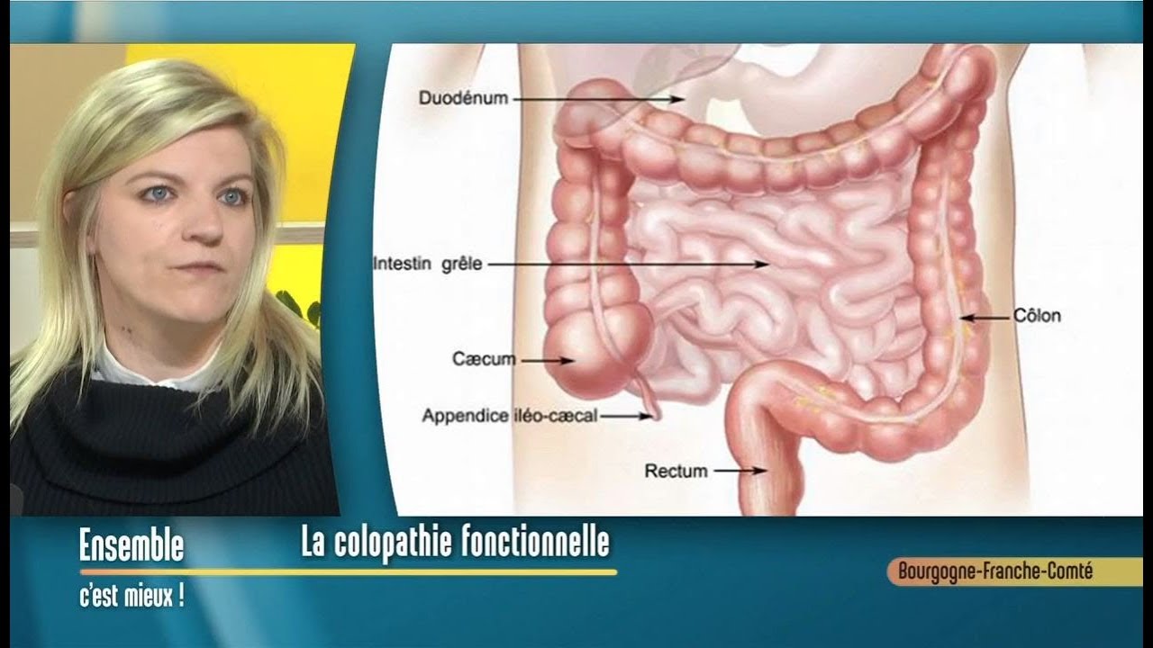 Le régime sans résidu en cas de colopathie fonctionnelle